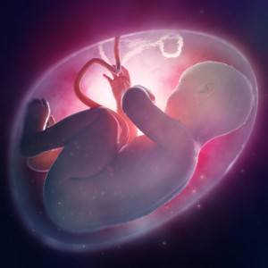 早期出産